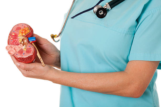 Cara Mengatasi Batu Ginjal pada Wanita Tips Ampuh untuk Kesehatan Ginjal